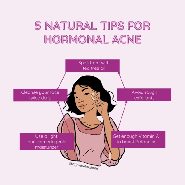 Best Tips for Hormonal Acne: Clear Skin Secrets Unveiled