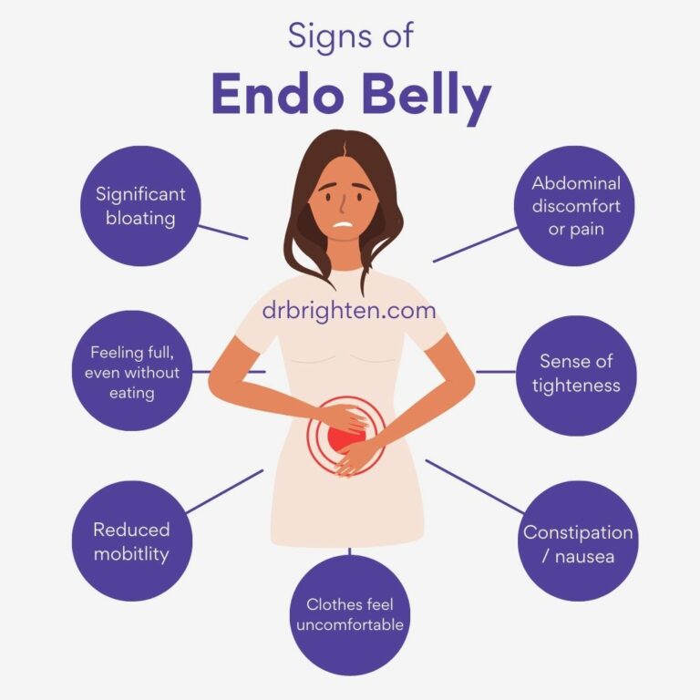 Endo Belly Causes and Treatments for Endometriosis Bloating Dr