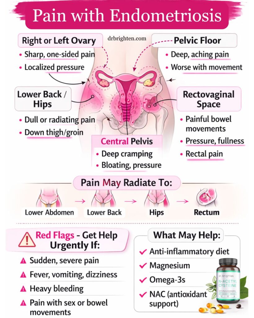 pelvic endometriosis pain